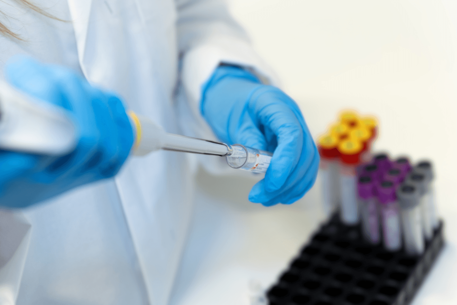 Laboratory researcher using a pipette to prepare samples for human nutrition analysis, with blood collection tubes in the background, illustrating clinical and bioavailability research.