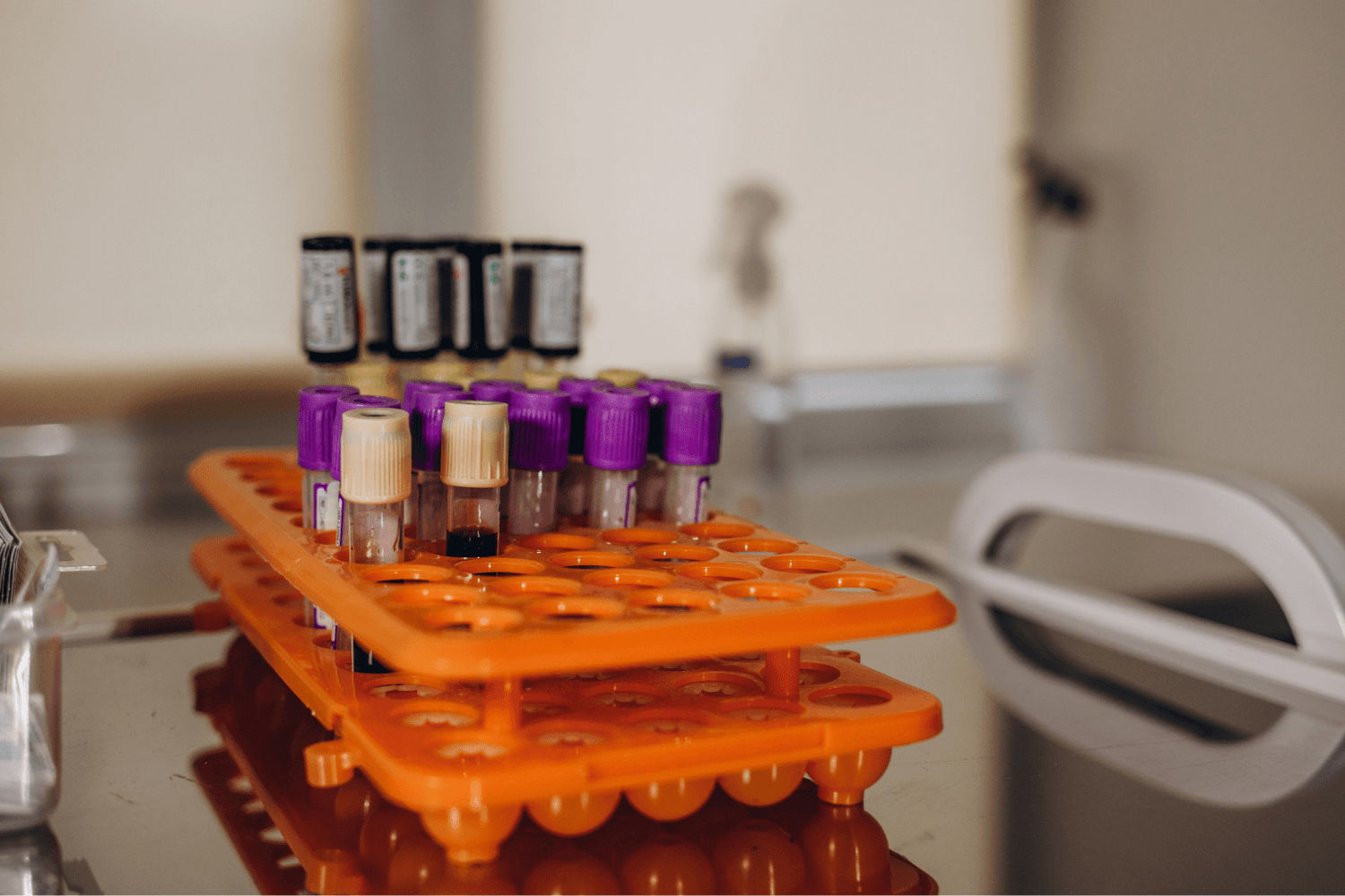 doctor hand taking a blood sample tube from a rack with machines of analysis in the lab background Technician holding blood tube test in the research laboratory