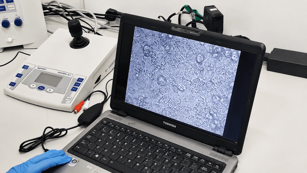 Close-up of a laboratory workstation with a laptop displaying a magnified microscopic image of microorganisms. Scientific instruments, cables, and controls surround the computer, while a gloved researcher operates the equipment in a microbiology research setting.